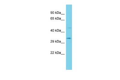 Western Blot: ACBD6 Antibody [NBP2-86944]