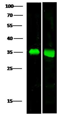 Western Blot: ACBD6 Antibody [NBP2-99708]