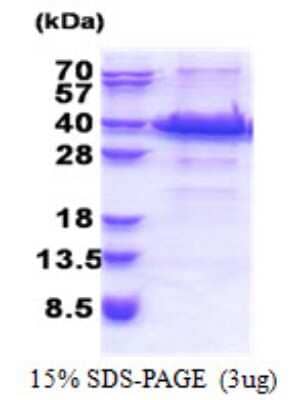 SDS-PAGE: Recombinant Human ACBD6 His Protein [NBP2-22673]