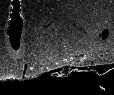 Immunocytochemistry/ Immunofluorescence: ACBD7 Antibody [NBP1-56527]