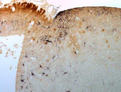 Immunohistochemistry-Paraffin: ACBD7 Antibody [NBP1-56527]