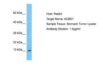 Western Blot: ACBD7 Antibody [NBP2-86945]