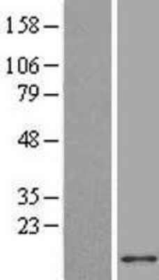 Western Blot: ACBD7 Overexpression Lysate [NBL1-07229]