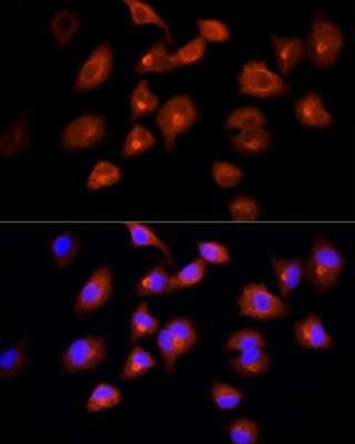 Immunocytochemistry/ Immunofluorescence: ACBP Antibody - Azide and BSA Free [NBP2-92856]
