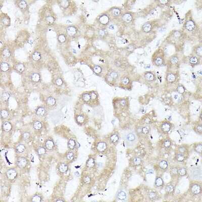 Immunohistochemistry-Paraffin: ACBP Antibody - Azide and BSA Free [NBP2-92856]