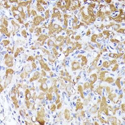 Immunohistochemistry-Paraffin: ACBP Antibody - Azide and BSA Free [NBP2-92856]