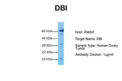 Western Blot: ACBP Antibody [NBP1-54806]