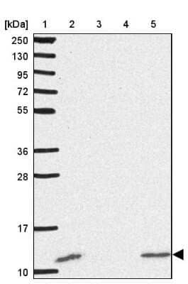 Western Blot: ACBP Antibody [NBP2-38648]