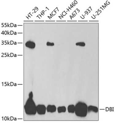 Western Blot: ACBP AntibodyBSA Free [NBP2-92457]