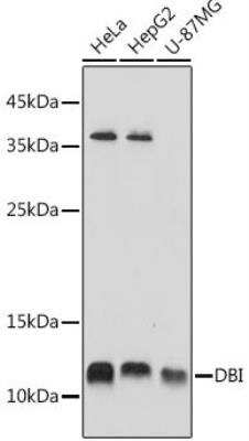 Western Blot: ACBP AntibodyAzide and BSA Free [NBP2-92856]
