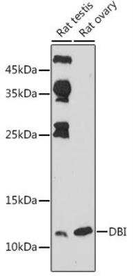 Western Blot: ACBP AntibodyAzide and BSA Free [NBP2-92856]