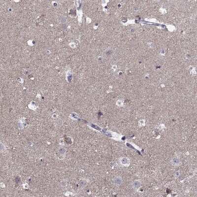 Immunohistochemistry-Paraffin: ACCN1 Antibody [NBP2-14321]