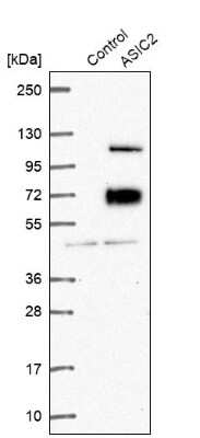 Western Blot: ACCN1 Antibody [NBP2-14321]