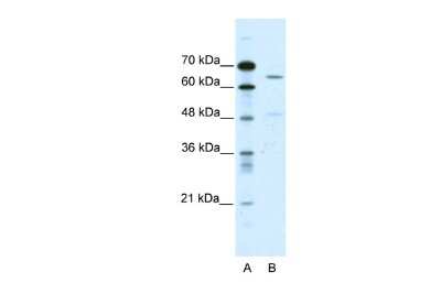 Western Blot: ACCN1 Antibody [NBP2-84380]