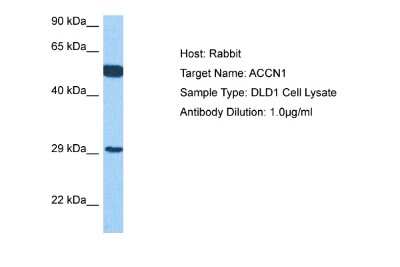 Western Blot: ACCN1 Antibody [NBP2-84382]