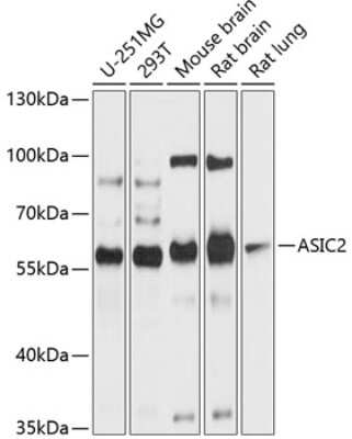 Western Blot: ACCN1 AntibodyBSA Free [NBP2-92023]