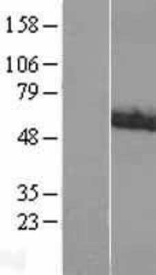 Western Blot: ACCN1 Overexpression Lysate [NBL1-07230]