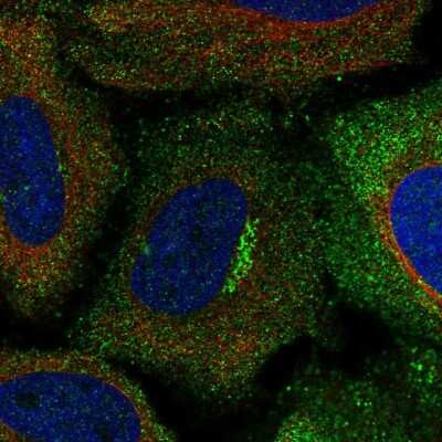 Immunocytochemistry/ Immunofluorescence: ACCN2 Antibody [NBP2-58458]