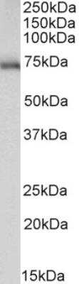 Western Blot: ACCN2 Antibody [NBP2-42507]