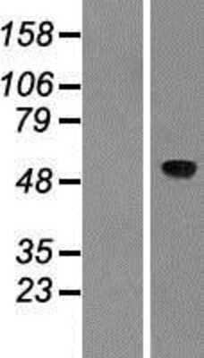 Western Blot: ACCN2 Overexpression Lysate [NBP2-08232]