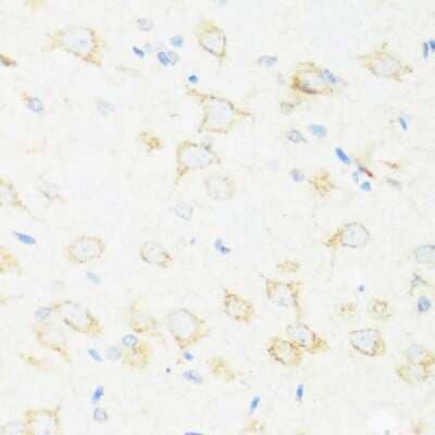 Immunohistochemistry-Paraffin: ACCN4 Antibody - Azide and BSA Free [NBP3-03688]