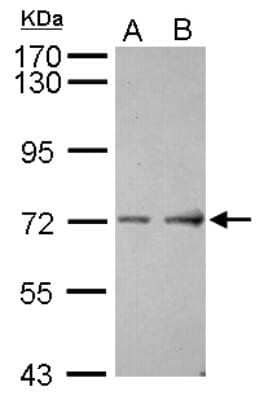 Western Blot: ACCN4 Antibody [NBP2-15241]