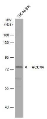 Western Blot: ACCN4 Antibody [NBP2-15241]