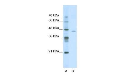 Western Blot: ACCN4 Antibody [NBP2-83921]