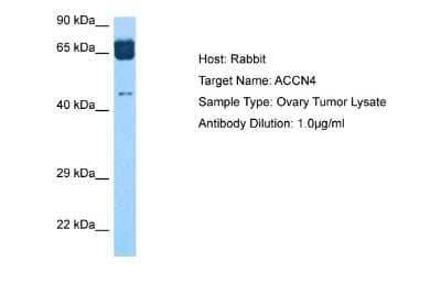 Western Blot: ACCN4 Antibody [NBP2-83922]