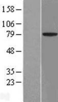 Western Blot: ACCN4 Overexpression Lysate [NBL1-07233]