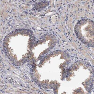 Immunohistochemistry: ACCN5 Antibody [NBP1-86356]