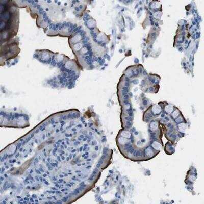 Immunohistochemistry-Paraffin: ACCN5 Antibody [NBP1-83258]