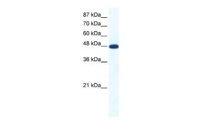 Western Blot: ACCN5 Antibody [NBP2-84384]