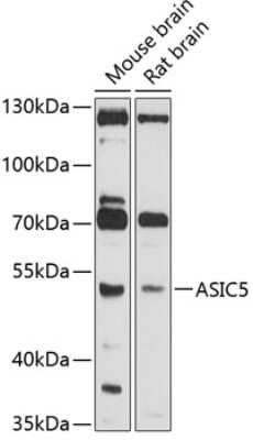 Western Blot: ACCN5 AntibodyBSA Free [NBP2-92010]