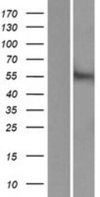 Western Blot: ACCN5 Overexpression Lysate [NBP2-06981]