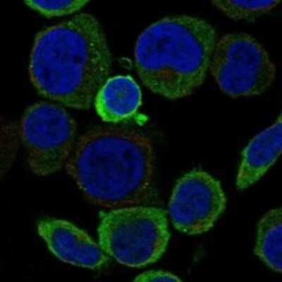 Immunocytochemistry/ Immunofluorescence: ACCSL Antibody [NBP3-17566]