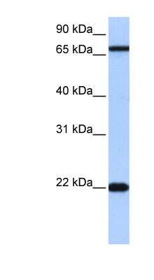 Western Blot: ACCSL Antibody [NBP1-70401]