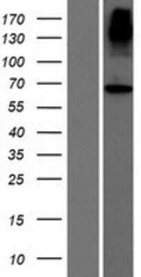 Western Blot: ACCSL Overexpression Lysate [NBP2-08596]