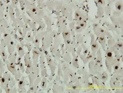 Immunohistochemistry-Paraffin: ACD Antibody (1D8-1B6) [H00065057-M02]