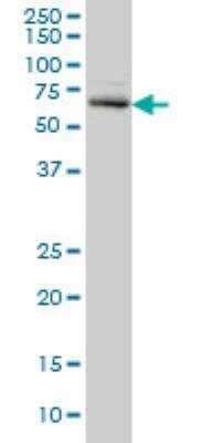 Western Blot: ACD Antibody (1D8-1B6) [H00065057-M02]