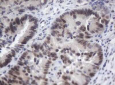 Immunohistochemistry: ACD Antibody (OTI2B1) [NBP2-45475]