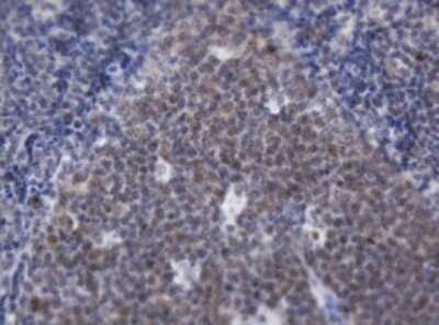 Immunohistochemistry: ACD Antibody (OTI2B1) [NBP2-45475]