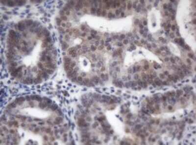 Immunohistochemistry: ACD Antibody (OTI2B1) [NBP2-45475]