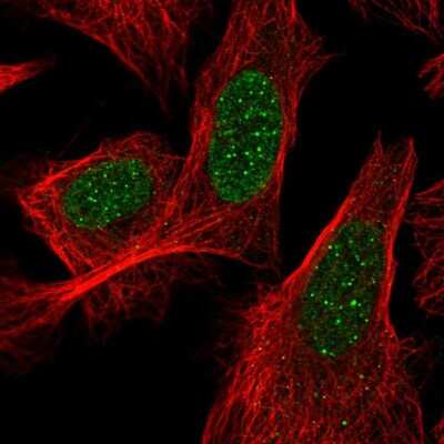 Immunocytochemistry/ Immunofluorescence: ACD Antibody [NBP2-58187]