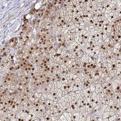 Immunohistochemistry-Paraffin: ACD Antibody [NBP2-33839]