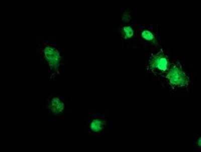 Immunocytochemistry/ Immunofluorescence: ACD Antibody (OTI1A2) - Azide and BSA Free [NBP2-72170]