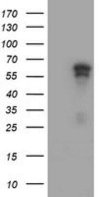 Western Blot: ACD Antibody (OTI1A2)Azide and BSA Free [NBP2-72170]