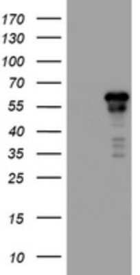 Western Blot: ACD Antibody (OTI2B1)Azide and BSA Free [NBP2-72169]