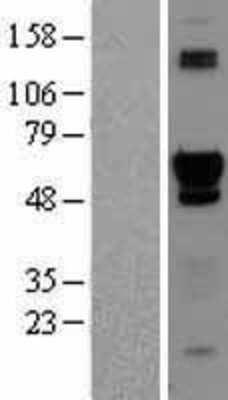 Western Blot: ACD Overexpression Lysate [NBL1-07235]