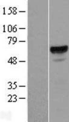 Western Blot: ACD Overexpression Lysate [NBL1-07236]